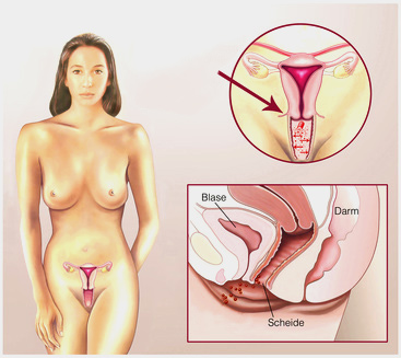 Verschiedene vaginas